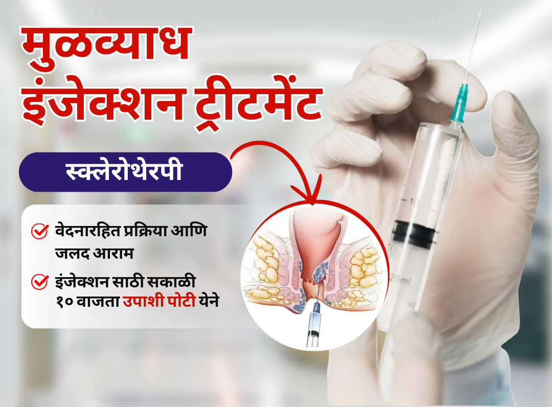 Piles Injection Treatment