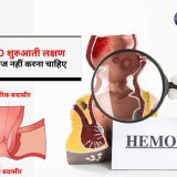 बवासीर के लक्षण