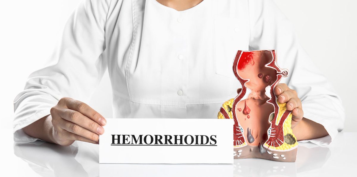 Piles-Hemorrhoids-Understanding-Symptoms-Causes-Treatment-and-Costs-Expert-Insights-1200x594.jpg