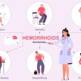 Hemorrhoid risk factors