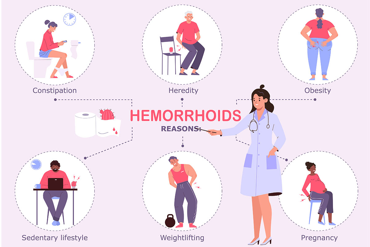 Hemorrhoid-risk-factors.jpg